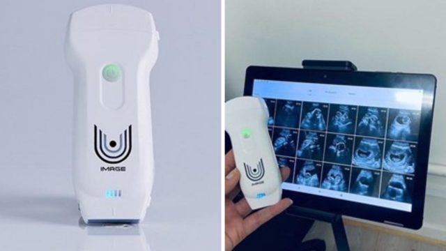 The U-Image wireless ultrasound device to be widely available in South Africa