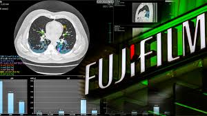 Fujifilm to support Digital transformation in Egypt’s Healthcare